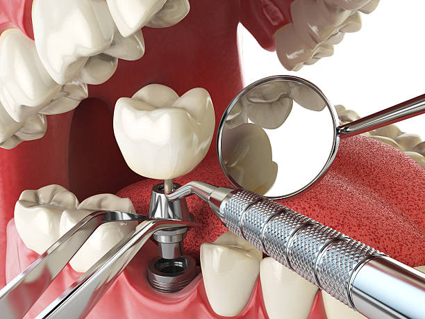 Dentist for Dental Trauma in AL